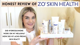 ZO Skincare Review Hydroquinone for Melasma did it work [upl. by Kress]