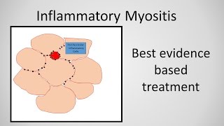 Myositis Inflammatory Myopathy Treatment [upl. by Kram225]