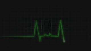 Heart Rate Monitor effect [upl. by Lauzon]