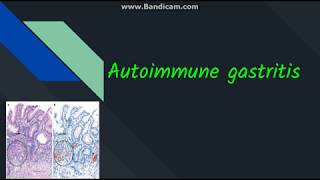 Autoimmune gastritis [upl. by Tobye]