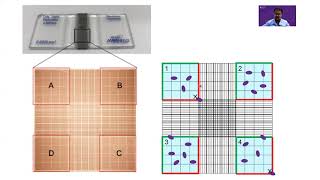 Counting cells on a hemocytometer [upl. by Conant]