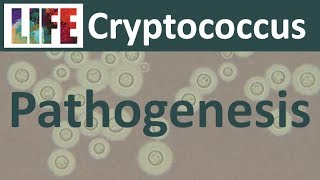 Cryptococcal meningitis pathogenesis and host response [upl. by Eseenaj]