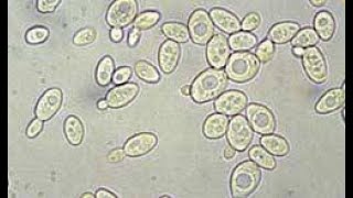 Activité B21 observation microscopique des levures de boulanger [upl. by Kyred771]