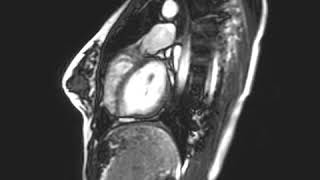 Heart MRI with sound [upl. by Nicole139]