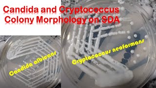 Candida and Cryptococcus colony morphology on SDA [upl. by Capp16]